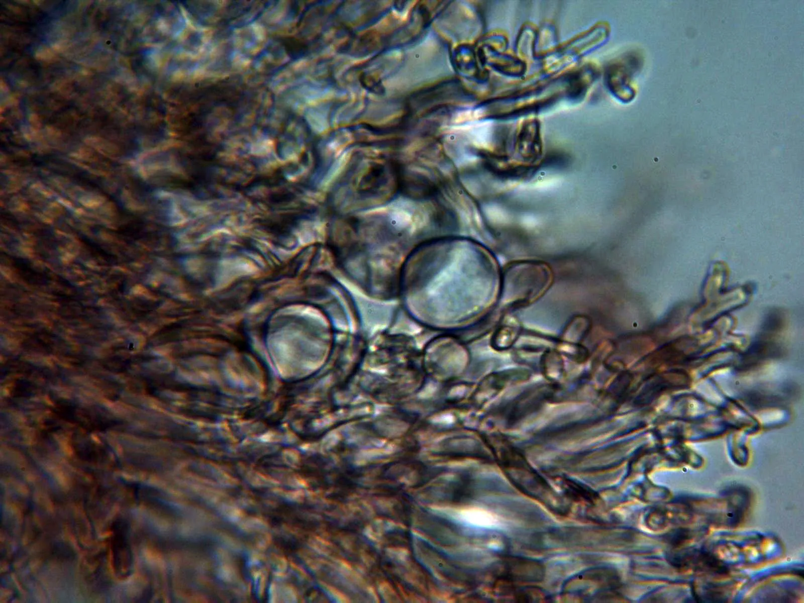 Microscopía de Pachnocybe albida - 10 - Conidióforos 1
